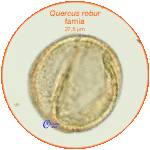 Quercus-robur-farnia-Pedunculate-Oak-pollen-polline-Medioevo-Carpi-Pollenflora-ARCHEOpalinologia-Foto-Carla-Alberta-Accorsi-150px