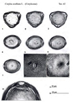 Corylus-avellana-nocciolo-Hazel-Polline-Pollen-Pollenflora-Flora-Palinologica-Italiana-Scheda-S84-De -Leonardis-et-Al-1984-150px