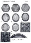 Fraxinus-ornus-frassino-da-manna-Manna-Ash-Polline-Pollen-Pollenflora-Flora-Palinologica-Italiana-Scheda-Sm81-De-Leonardis-et-Al-1984-150px