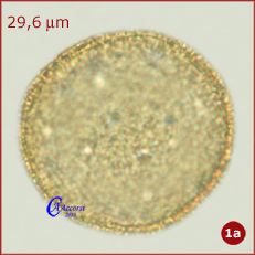 Buxus-sempervirens-bosso-Box-Polline-Pollen-Altre-Foto-1a-Tipi-di-Riferimento-Acetolizzati-Pollenflora-MORFOpalinologia-Foto-Carla-Alberta-Accorsi-231px