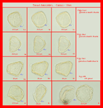 Taxus-baccata-tasso-Yew-Polline-Pollen-Tipi-di-Riferimento-acetolizzati-Pollenflora-MORFOpalinologia-Foto-Accorsi-Pagina-Foto-150px